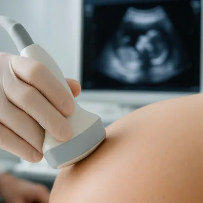 Bezpłatne kursy z diagnostyki prenatalnej dla studentów i kadry medycznej